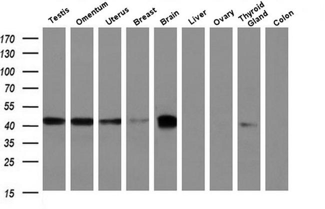 BCAT1 Antibody in Western Blot (WB)