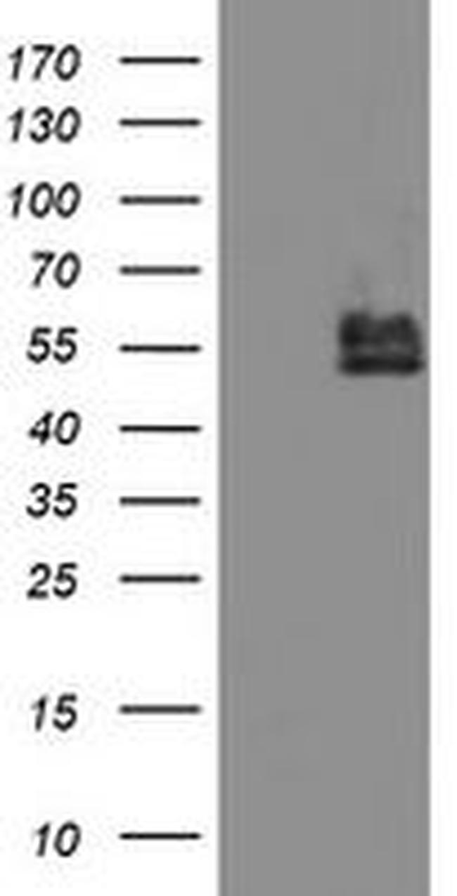 BCAT1 Antibody in Western Blot (WB)