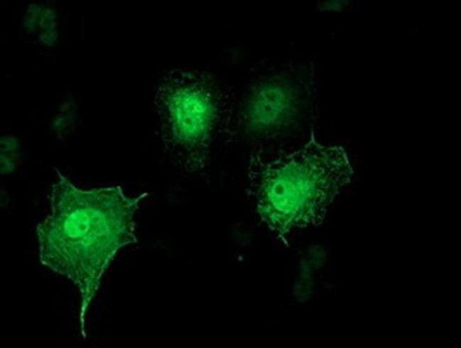 SH2D2A Antibody in Immunocytochemistry (ICC/IF)