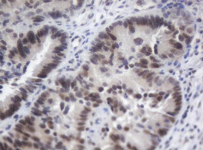 ACD Antibody in Immunohistochemistry (Paraffin) (IHC (P))