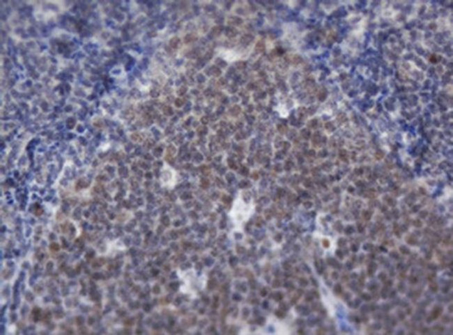 ACD Antibody in Immunohistochemistry (Paraffin) (IHC (P))