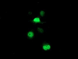 PSMB7 Antibody in Immunocytochemistry (ICC/IF)