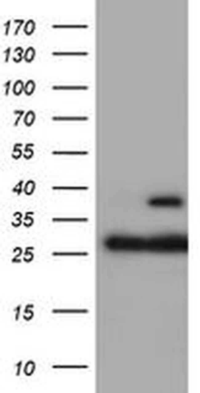 PSMB7 Antibody in Western Blot (WB)