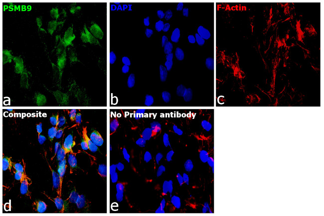 PSMB9 Antibody in Immunocytochemistry (ICC/IF)