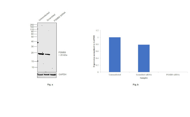 PSMB9 Antibody