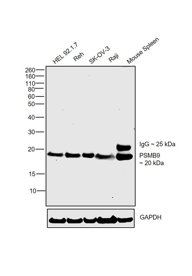 PSMB9 Antibody in Western Blot (WB)