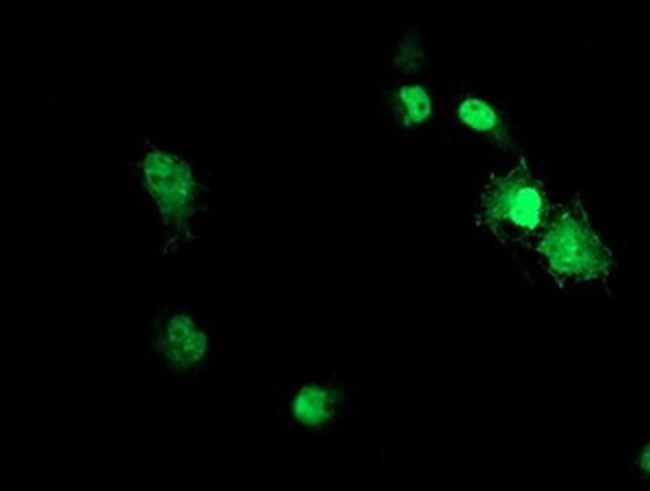 ACD Antibody in Immunocytochemistry (ICC/IF)