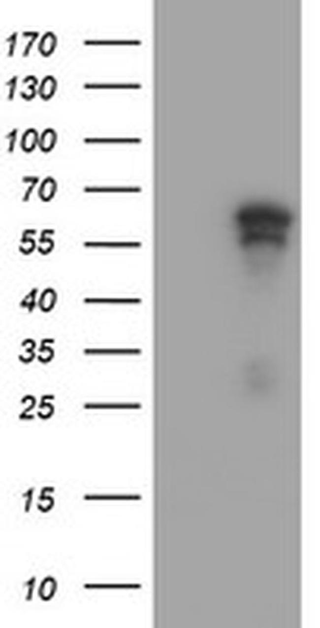 ACD Antibody in Western Blot (WB)