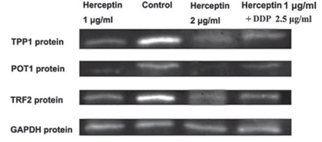 ACD Antibody in Western Blot (WB)