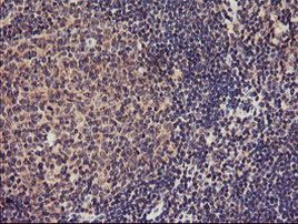 TMEFF2 Antibody in Immunohistochemistry (Paraffin) (IHC (P))