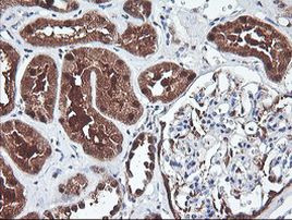 PSMB7 Antibody in Immunohistochemistry (Paraffin) (IHC (P))