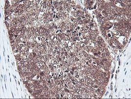 PSMB7 Antibody in Immunohistochemistry (Paraffin) (IHC (P))