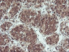 PSMB7 Antibody in Immunohistochemistry (Paraffin) (IHC (P))