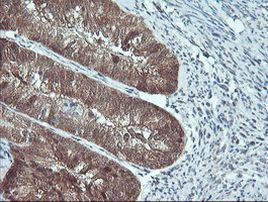 PSMB7 Antibody in Immunohistochemistry (Paraffin) (IHC (P))