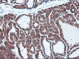 PSMB7 Antibody in Immunohistochemistry (Paraffin) (IHC (P))