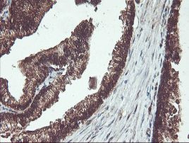 PSMB7 Antibody in Immunohistochemistry (Paraffin) (IHC (P))