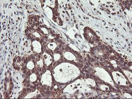 PSMB7 Antibody in Immunohistochemistry (Paraffin) (IHC (P))