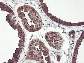 PSMB7 Antibody in Immunohistochemistry (Paraffin) (IHC (P))