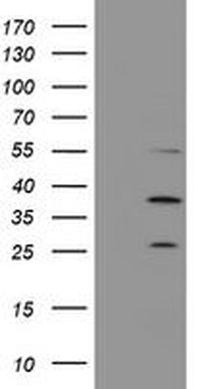 PSMB7 Antibody in Western Blot (WB)