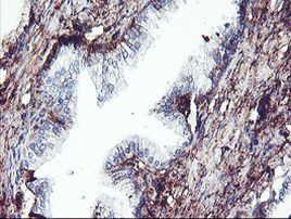 SCHIP1 Antibody in Immunohistochemistry (Paraffin) (IHC (P))