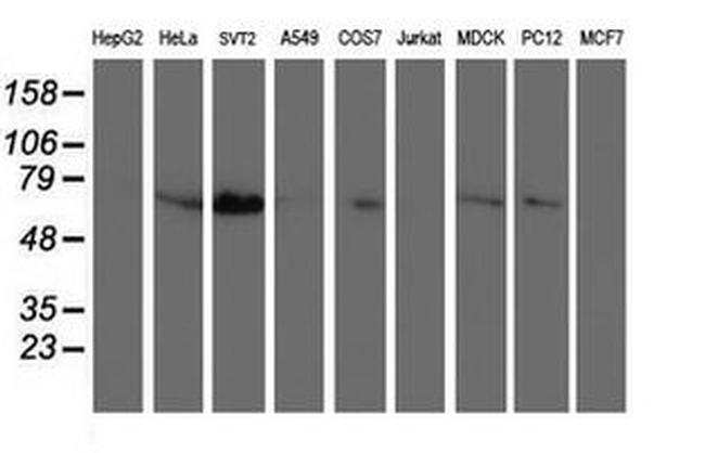 SCHIP1 Antibody in Western Blot (WB)