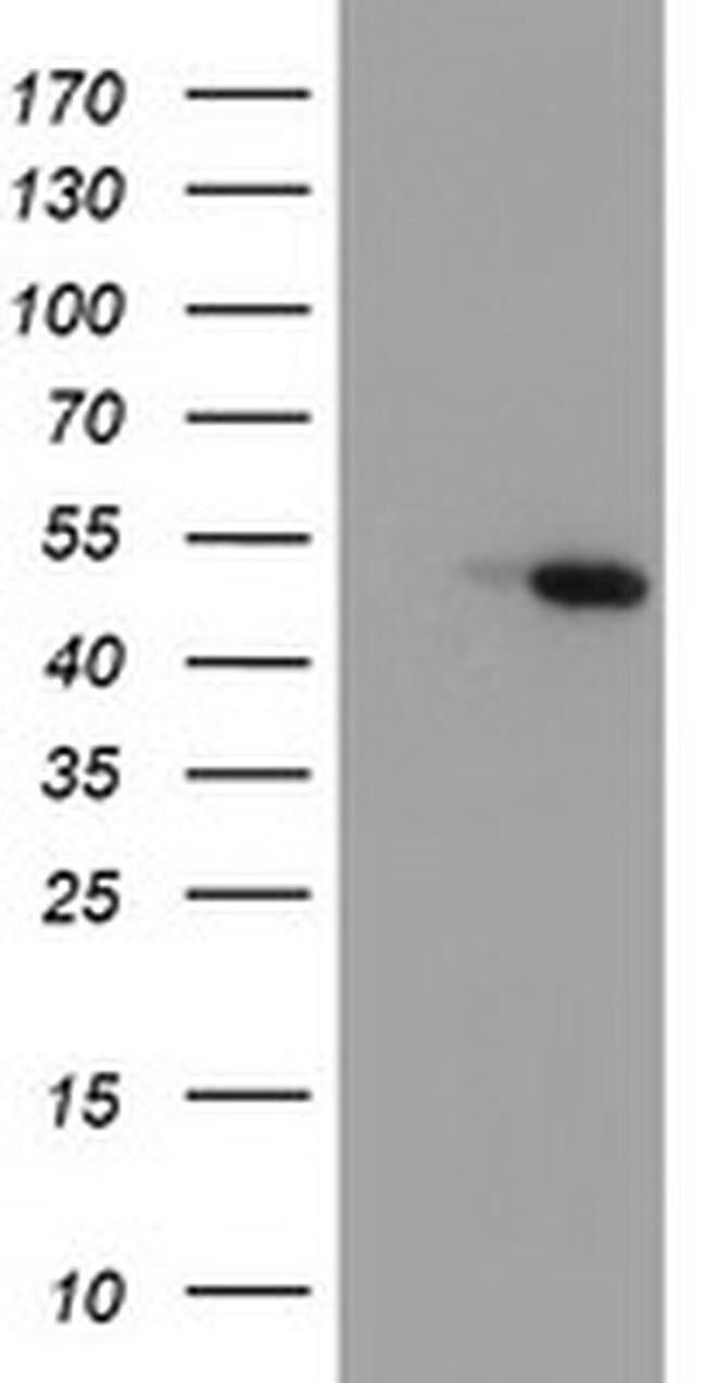 Carboxypeptidase A1 Antibody in Western Blot (WB)