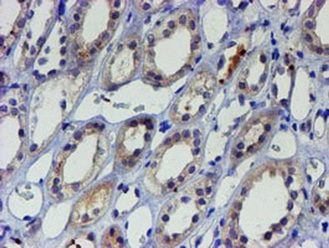 LIM1 Antibody in Immunohistochemistry (Paraffin) (IHC (P))