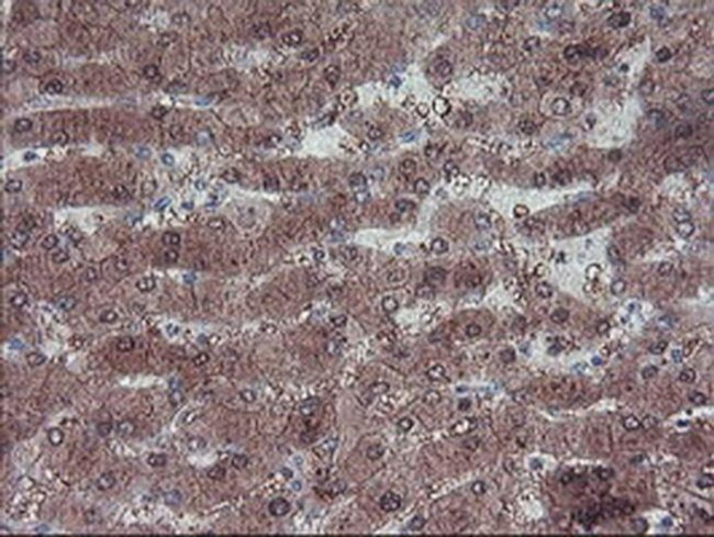 LIM1 Antibody in Immunohistochemistry (Paraffin) (IHC (P))