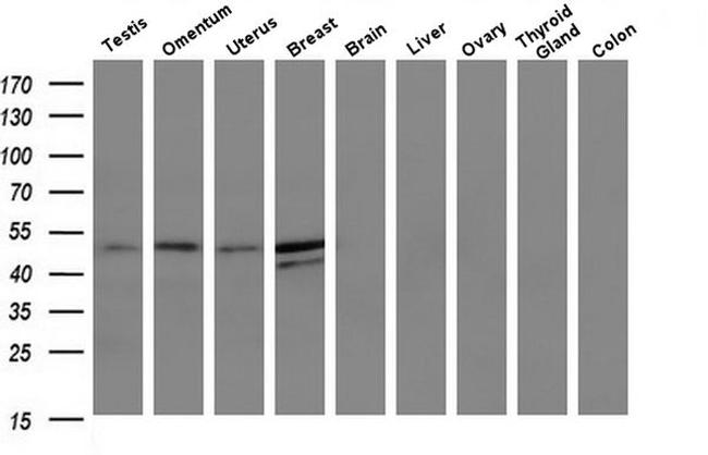 TMEFF2 Antibody in Western Blot (WB)