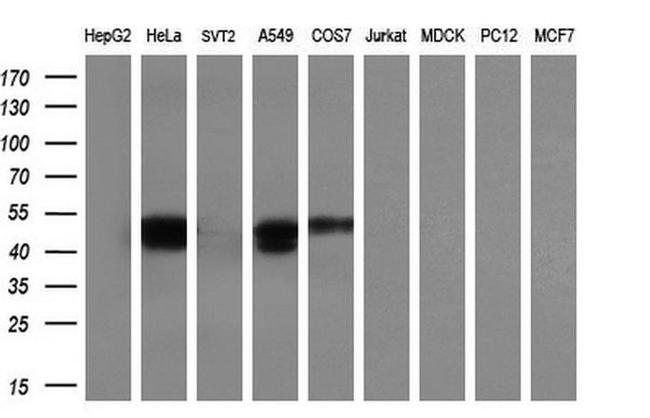 SERPINE2 Antibody in Western Blot (WB)