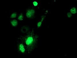 SAT2 Antibody in Immunocytochemistry (ICC/IF)