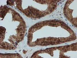 SAT2 Antibody in Immunohistochemistry (Paraffin) (IHC (P))