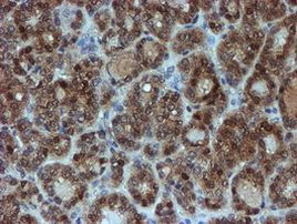 SAT2 Antibody in Immunohistochemistry (Paraffin) (IHC (P))