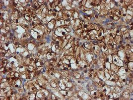 SAT2 Antibody in Immunohistochemistry (Paraffin) (IHC (P))