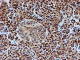 SAT2 Antibody in Immunohistochemistry (Paraffin) (IHC (P))