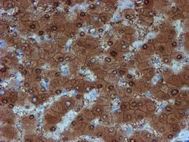 SAT2 Antibody in Immunohistochemistry (Paraffin) (IHC (P))