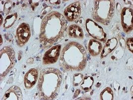 SAT2 Antibody in Immunohistochemistry (Paraffin) (IHC (P))