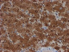 SAT2 Antibody in Immunohistochemistry (Paraffin) (IHC (P))