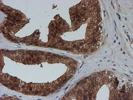 SAT2 Antibody in Immunohistochemistry (Paraffin) (IHC (P))