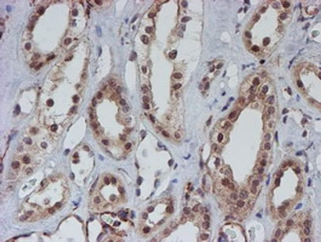 ATRIP Antibody in Immunohistochemistry (Paraffin) (IHC (P))