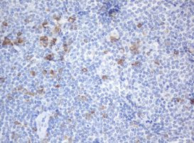 SRPRB Antibody in Immunohistochemistry (Paraffin) (IHC (P))