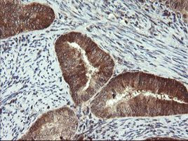 PPAT Antibody in Immunohistochemistry (Paraffin) (IHC (P))