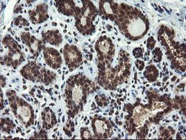 PPAT Antibody in Immunohistochemistry (Paraffin) (IHC (P))