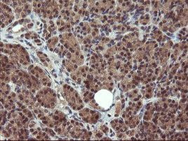 PPAT Antibody in Immunohistochemistry (Paraffin) (IHC (P))