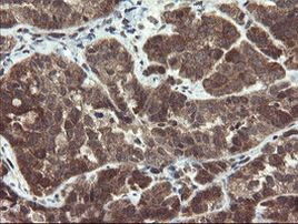 PPAT Antibody in Immunohistochemistry (Paraffin) (IHC (P))