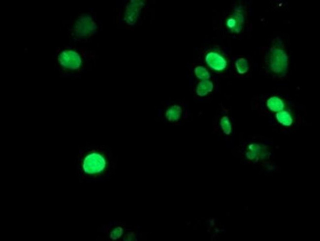 METT10D Antibody in Immunocytochemistry (ICC/IF)