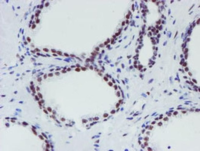 METT10D Antibody in Immunohistochemistry (Paraffin) (IHC (P))