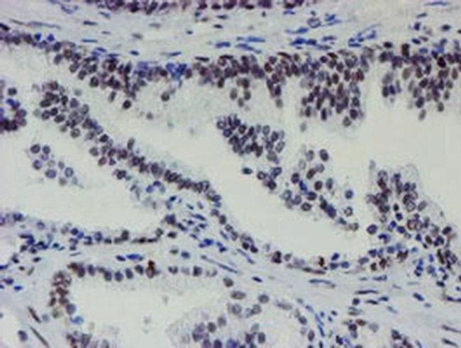 METT10D Antibody in Immunohistochemistry (Paraffin) (IHC (P))