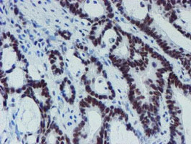 METT10D Antibody in Immunohistochemistry (Paraffin) (IHC (P))