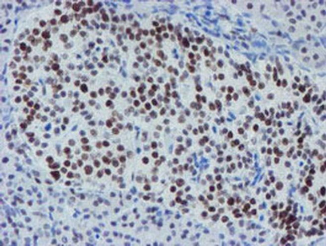 METT10D Antibody in Immunohistochemistry (Paraffin) (IHC (P))